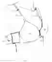 Fig. 07 - Bra