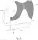 Fig. 03 - Kinematic bra for posture recovery and thoracic mobility