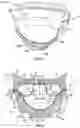 Fig. 03 - Midsole system with graded response