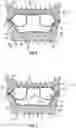 Fig. 04 - Midsole system with graded response