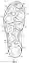 Fig. 06 - Midsole system with graded response