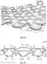 Fig. 11 - Midsole system with graded response