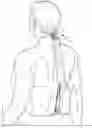 Fig. 01 - Hair Retaining Device