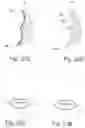 Fig. 12 - Method for manufacturing a personalized applicator for the application of a cosmetic composition