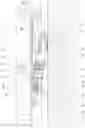 Fig. 03 - Concealed tear-resistant hanging-bracket group with precise depth adjustment