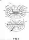 Fig. 02 - Ice restrainer apparatus