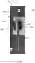 Fig. 09 - COOKING UTENSIL WITH RETRACTABLE SHIELD