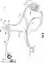 Fig. 11 - Extendable Jet Assembly and Liquid Circulation System