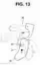 Fig. 10 - LIGHT SOURCE APPARATUS FOR ENDOSCOPE