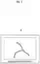 Fig. 06 - Endoscope system and method of operating the same