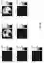 Fig. 14 - Systems and methods of optimizing functional images of a lesion region using guided diffuse optical tomography