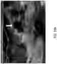 Fig. 19 - Systems and methods of optimizing functional images of a lesion region using guided diffuse optical tomography