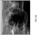 Fig. 24 - Systems and methods of optimizing functional images of a lesion region using guided diffuse optical tomography