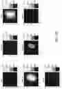 Fig. 25 - Systems and methods of optimizing functional images of a lesion region using guided diffuse optical tomography