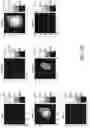 Fig. 30 - Systems and methods of optimizing functional images of a lesion region using guided diffuse optical tomography