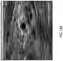 Fig. 31 - Systems and methods of optimizing functional images of a lesion region using guided diffuse optical tomography