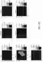 Fig. 37 - Systems and methods of optimizing functional images of a lesion region using guided diffuse optical tomography
