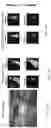 Fig. 44 - Systems and methods of optimizing functional images of a lesion region using guided diffuse optical tomography