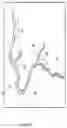 Fig. 07 - SYSTEMS AND METHODS FOR DIAGNOSING CORONARY MICROVASCULAR DISEASE