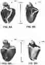 Fig. 08 - Systems and methods for assessing heart function