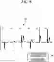 Fig. 05 - Electrocardiogram analysis apparatus and electrocardiogram system