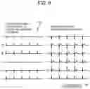 Fig. 06 - Electrocardiogram analysis apparatus and electrocardiogram system