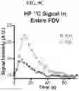 Fig. 12 - Hyperpolarized and deuterium exchanged hyperpolarizedC and N-labeled xanthine, arginine, glutamine, and urea probes