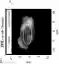 Fig. 07 - High-isolation transmit/receive surface coils for EPRI