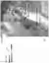 Fig. 13 - High-isolation transmit/receive surface coils for EPRI