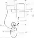 Fig. 01 - System for capturing respiratory effort of a patient