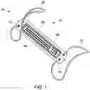 Fig. 02 - Pressure sensing implant