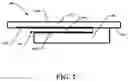 Fig. 03 - Pressure sensing implant