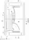 Fig. 05 - Pressure sensing implant