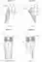 Fig. 12 - METHOD AND APPARATUS FOR CLASSIFYING POSITION OF TORSO AND LIMB OF A MAMMAL