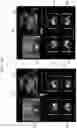 Fig. 10 - Method and apparatus for displaying ultrasound image providing orientation of fetus and computer program product