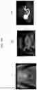 Fig. 16 - Method and apparatus for displaying ultrasound image providing orientation of fetus and computer program product