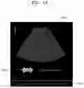 Fig. 18 - Method and apparatus for displaying ultrasound image providing orientation of fetus and computer program product