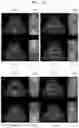 Fig. 19 - Method and apparatus for displaying ultrasound image providing orientation of fetus and computer program product