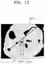 Fig. 20 - Method and apparatus for displaying ultrasound image providing orientation of fetus and computer program product