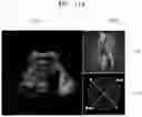 Fig. 25 - Method and apparatus for displaying ultrasound image providing orientation of fetus and computer program product