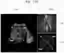 Fig. 26 - Method and apparatus for displaying ultrasound image providing orientation of fetus and computer program product
