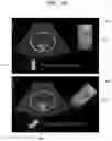 Fig. 27 - Method and apparatus for displaying ultrasound image providing orientation of fetus and computer program product