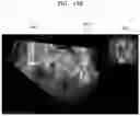 Fig. 28 - Method and apparatus for displaying ultrasound image providing orientation of fetus and computer program product