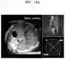 Fig. 29 - Method and apparatus for displaying ultrasound image providing orientation of fetus and computer program product