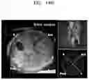 Fig. 30 - Method and apparatus for displaying ultrasound image providing orientation of fetus and computer program product