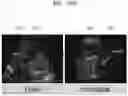 Fig. 32 - Method and apparatus for displaying ultrasound image providing orientation of fetus and computer program product