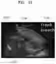 Fig. 33 - Method and apparatus for displaying ultrasound image providing orientation of fetus and computer program product
