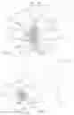 Fig. 02 - Interspinous implants