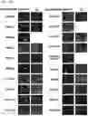 Fig. 05 - Novel Compounds for Imaging Tau Proteins That Accumulate in the Brain