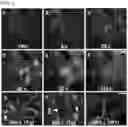 Fig. 07 - Novel Compounds for Imaging Tau Proteins That Accumulate in the Brain